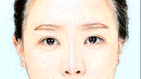 祛斑小妙招(9月更新)_2024祛斑收費(fèi)價(jià)目表