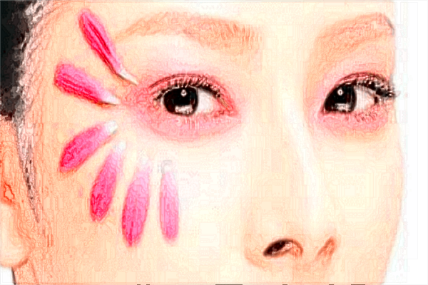 上瞼提肌有哪些注意事項(xiàng)?上瞼提肌術(shù)價(jià)目表?