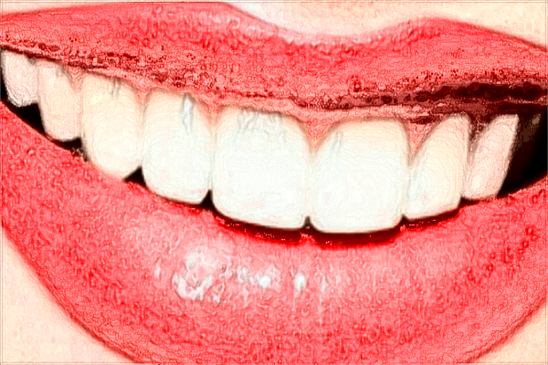 2024鄭大一附院正畸價格表(價目表)一覽