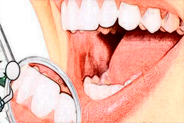 2024鄭大一附院正畸價格表(價目表)一覽