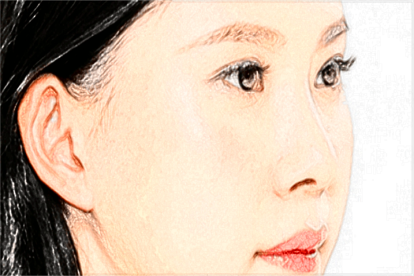 2024上海長(zhǎng)征醫(yī)院脂肪填充價(jià)格_填充全臉多久恢復(fù)