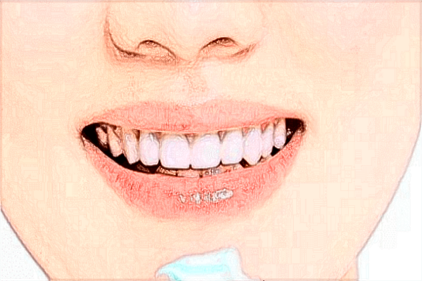 北京天壇醫(yī)院牙齒矯正怎么樣【牙齒矯正案例】