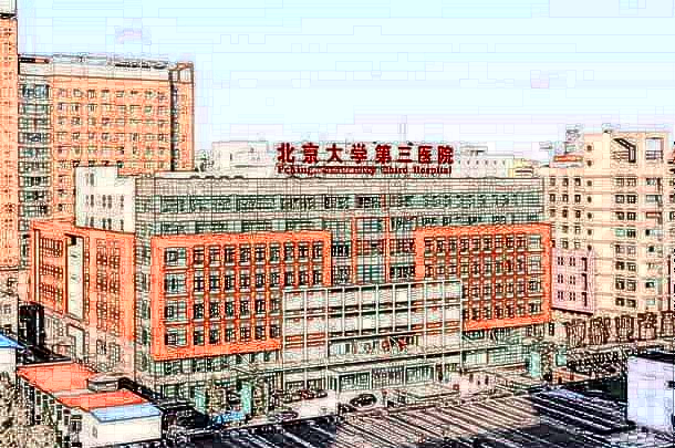 北京大學第三醫(yī)院牙齒正畸價格?牙齒矯正有幾種方式