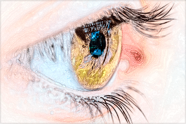 做雙眼皮需要注意事項?切開雙眼皮價格2024