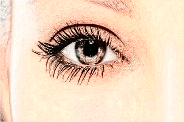 安醫(yī)附二院眼瞼矯正多少錢?眼瞼矯正手術(shù)—般多久恢復(fù)