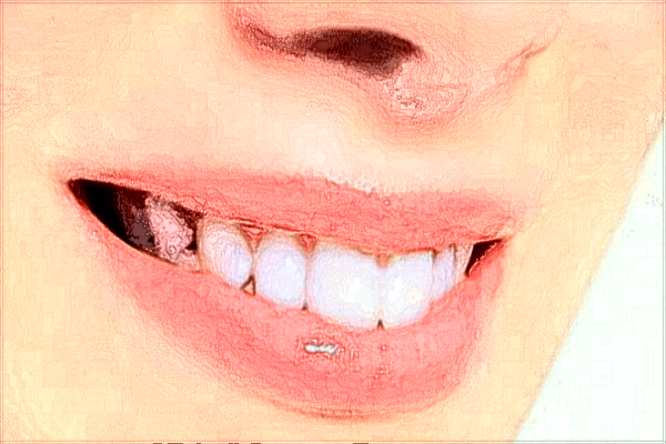 常熟二院牙齒矯正醫(yī)生技術(shù)好嗎?醫(yī)生收費(fèi)價格2024