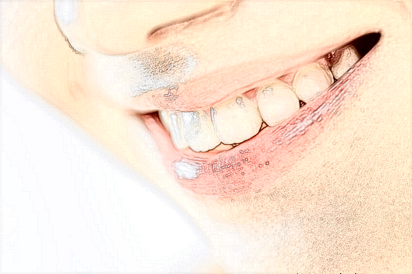 2024-2024淮北市人民醫(yī)院牙齒矯正價格【牙齒矯正案例】