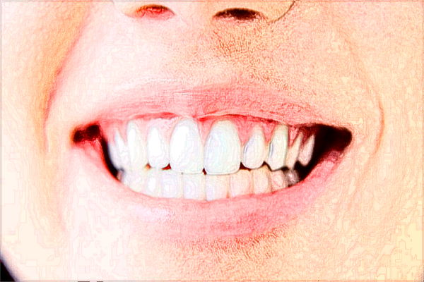 河北省口腔醫(yī)院正頜收費標(biāo)準(zhǔn)_哪個醫(yī)生做的好
