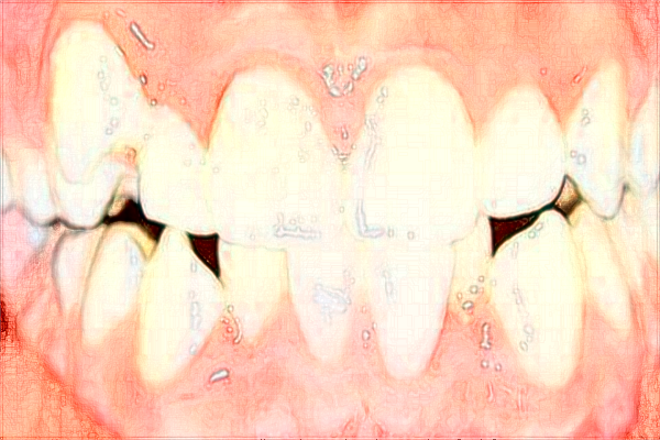 福建醫(yī)科大學(xué)附屬第一醫(yī)院口腔科哪個(gè)醫(yī)生好?2024收費(fèi)價(jià)格公布