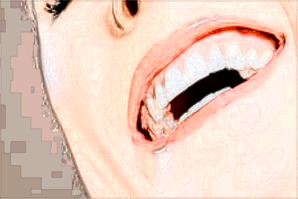北大口腔醫(yī)院補(bǔ)牙的費(fèi)用是多少_哪個(gè)醫(yī)生做的好