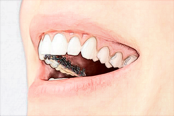 無錫市中醫(yī)院補(bǔ)牙價目表(價格表)怎么樣