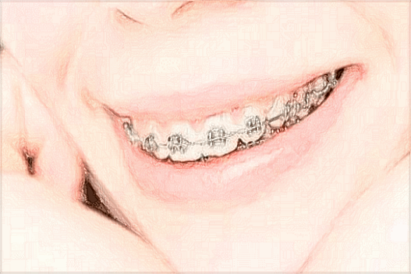 2024河北醫(yī)科大學口腔醫(yī)院是三甲醫(yī)院嗎?醫(yī)生名單+價格