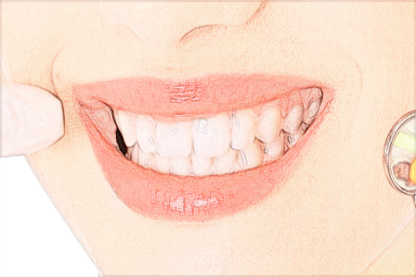 2024河北醫(yī)科大學口腔醫(yī)院是三甲醫(yī)院嗎?醫(yī)生名單+價格