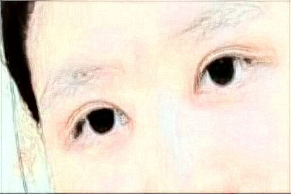 哈爾濱醫(yī)科大學(xué)附屬第一醫(yī)院全飛秒做的好嗎_需要多少錢