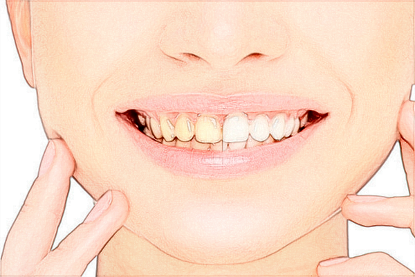 武漢大學口腔醫(yī)院口腔科醫(yī)生好嗎?2024口腔科收費價目表