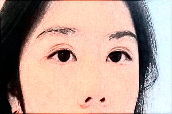 2024哈爾濱醫(yī)科大學(xué)附屬第二醫(yī)院全飛秒多少費用?醫(yī)生推薦