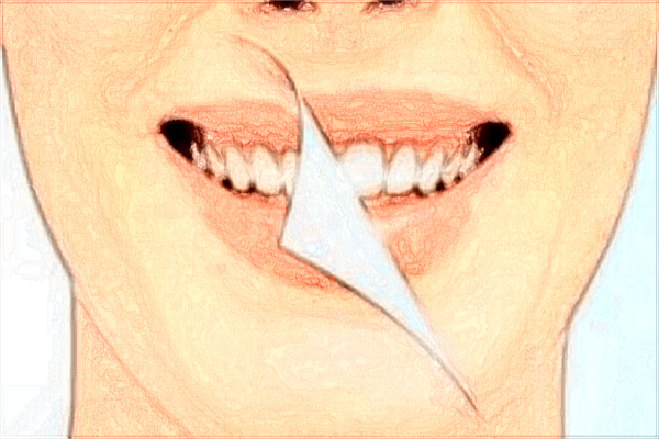 2024中山大學附屬第三醫(yī)院矯正牙齒費用?矯正牙齒臉型會變嗎