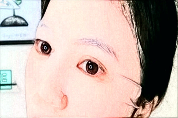 阜陽市人民醫(yī)院全飛秒價(jià)目表(價(jià)格表)怎么樣