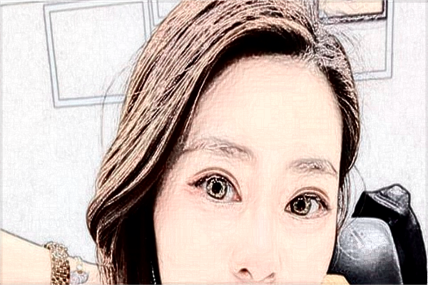 ?？谑腥嗣襻t(yī)院醫(yī)美怎么樣?醫(yī)美項目都有哪些