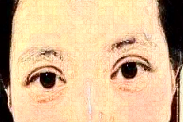 2024徐州醫(yī)科大學附屬醫(yī)院割雙眼皮多少錢_醫(yī)生名單推薦