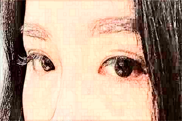 煙臺毓璜頂醫(yī)院隆鼻怎么樣?假體隆鼻能保持幾年?