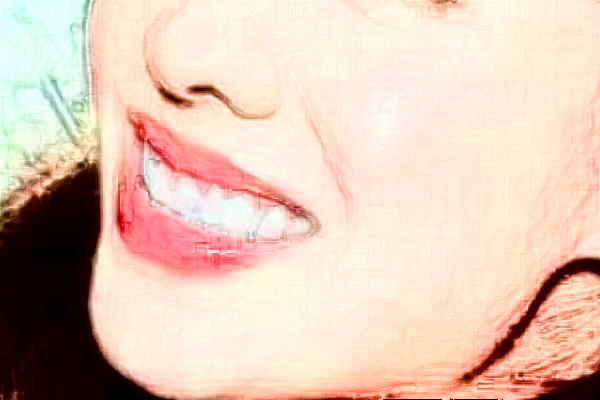 鄭州植得口腔醫(yī)院全瓷牙能用多久?2024全瓷牙價格