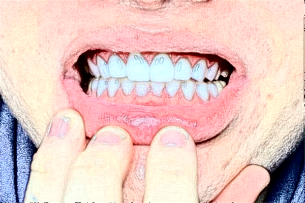 福州登特口腔醫(yī)院補(bǔ)牙好的大夫?醫(yī)生簡(jiǎn)介