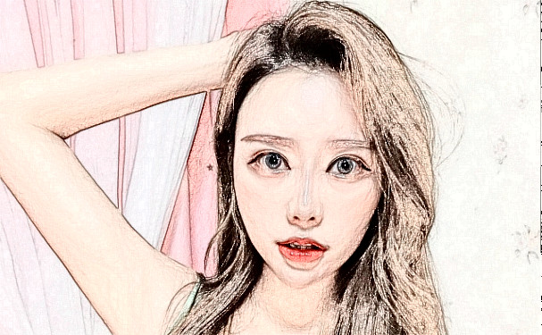 成都恒博天姿醫(yī)療美容門診部玻尿酸填充全臉90天案例欣賞|技術(shù)測評(píng)怎么樣?費(fèi)用多少