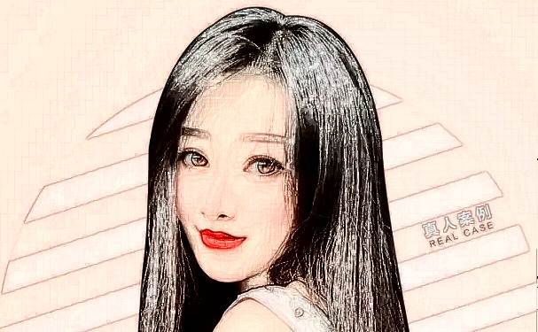 青島市南區(qū)諾美德醫(yī)學(xué)美容門診部打玻尿酸技術(shù)等級(jí)怎么樣?野生案例&價(jià)目一覽表