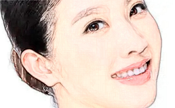 溫嶺臻美醫(yī)療美容面部除皺90天術(shù)后恢復(fù)案例|技術(shù)水準(zhǔn)怎么樣?費(fèi)用查詢