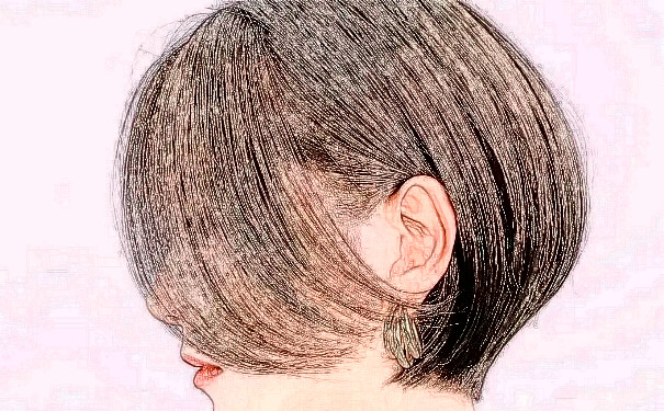 南昌萊美美容醫(yī)院植發(fā)費(fèi)用明細(xì)?半年案例恢復(fù)過(guò)程