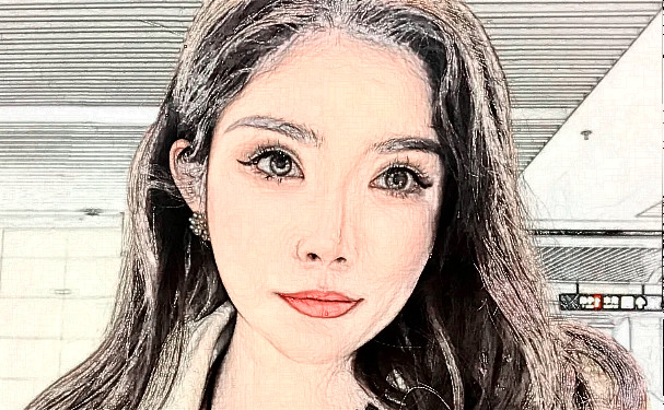 烏魯木齊花之妍醫(yī)療美容整形醫(yī)院脂肪填充三個(gè)月術(shù)后恢復(fù)案例&技術(shù)怎么樣?