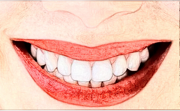 上海九院張樺牙套正畸技術(shù)能力怎么樣?術(shù)后案例&效果測評