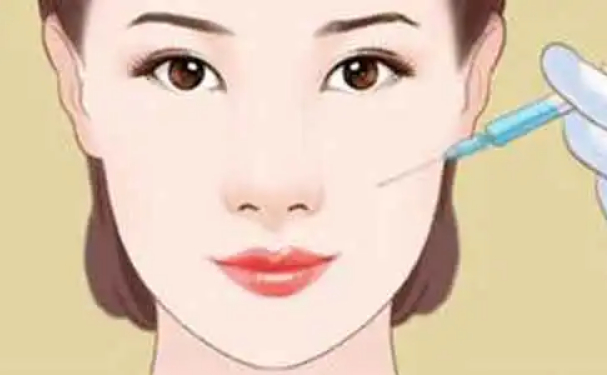 宜昌市中心人民醫(yī)院膠原蛋白填充鼻唇溝醫(yī)生排名,費用明細?心動案例